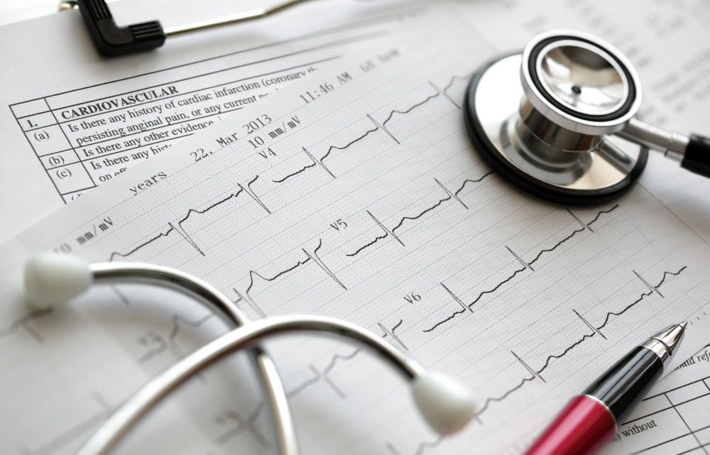 Asthma, Cardiovascular